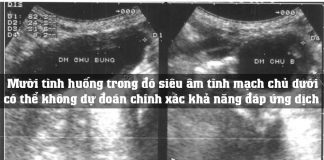 Mười tình huống trong đó siêu âm tĩnh mạch chủ dưới có thể không dự đoán chính xác khả năng đáp ứng dịch
