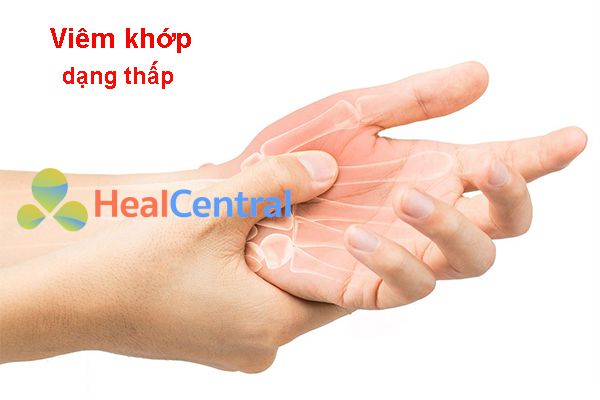 Viêm khớp dạng thấp có thực sự nguy hiểm? Nguyên nhân và cách điều trị