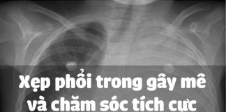 Xẹp phổi trong gây mê và chăm sóc tích cực