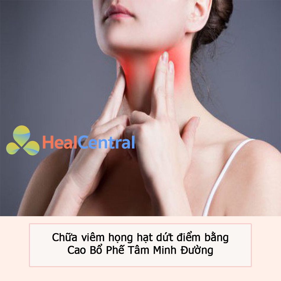 Chữa viêm họng hạt dứt điểm bằng Cao Bổ Phế Tâm Minh Đường