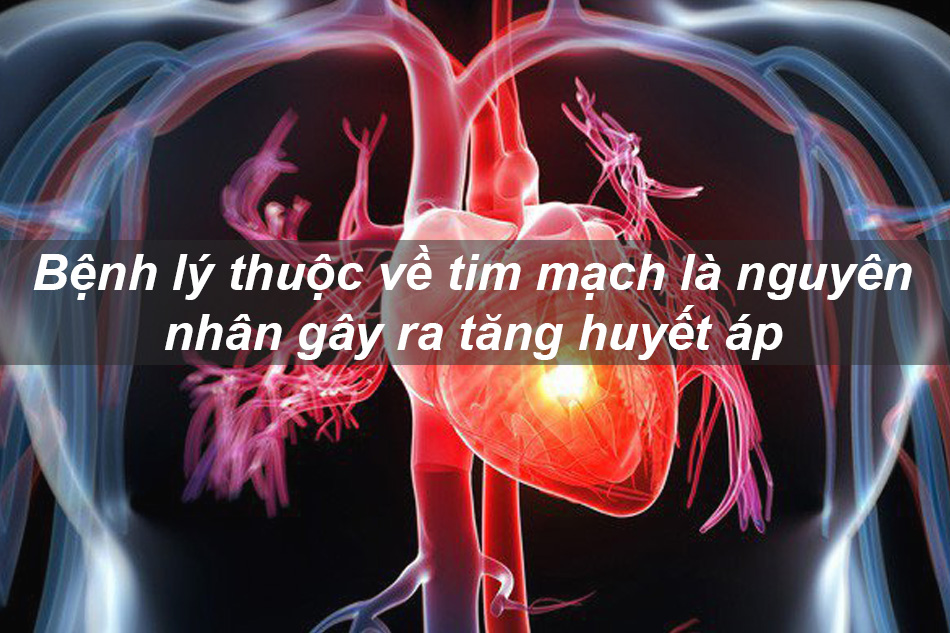 Bệnh lý tim mạch là nguyên nhân gây ra tăng huyết áp