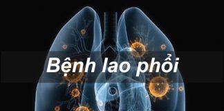 Bệnh lao phổi