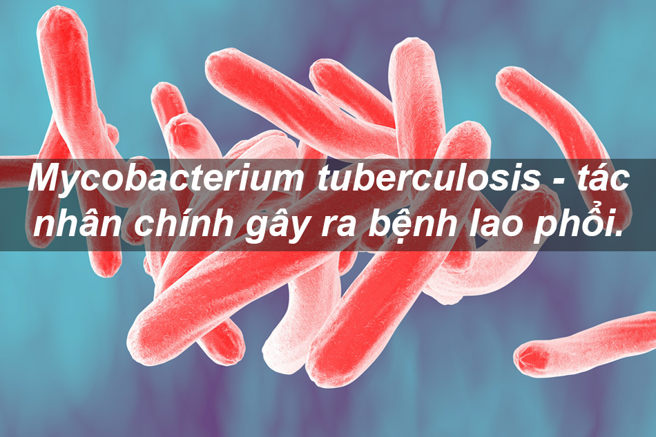 Mycobacterium tuberculosis là tác nhân chính gây nên bệnh lao phổi