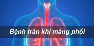 Bệnh tràn khí màng phổi