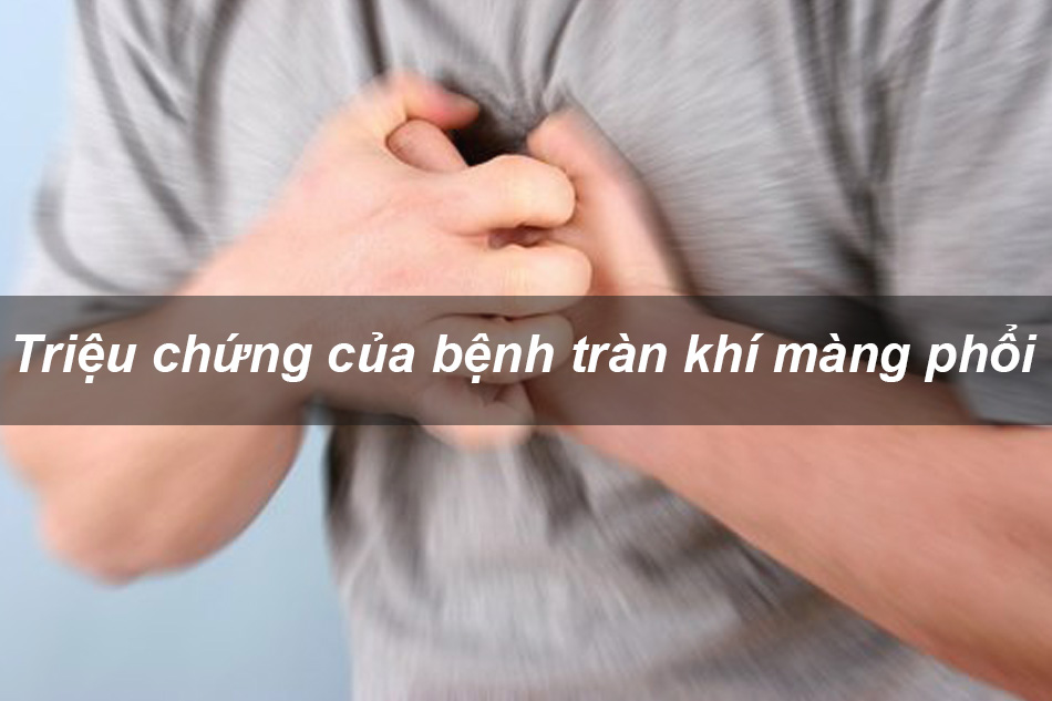 Triệu chứng của bệnh tràn khí màng phổi