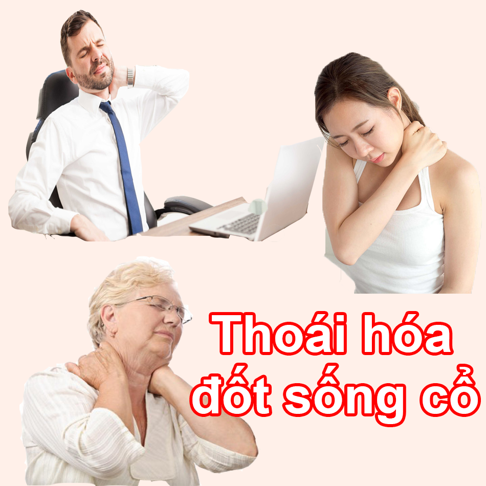 Một số hình ảnh của thoái hóa đốt sống cổ