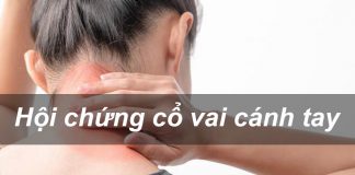 Hội chứng cổ vai cánh tay