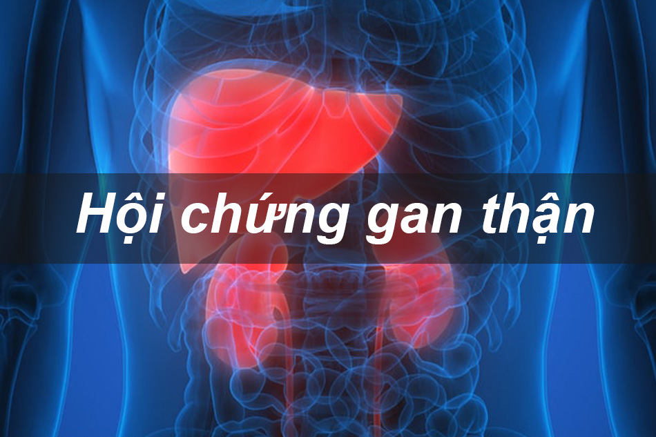 Hội chứng gan thận: Cơ chế, Có nguy hiểm không, Tiêu chuẩn chẩn đoán