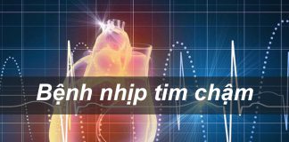 Bệnh nhịp tim chậm