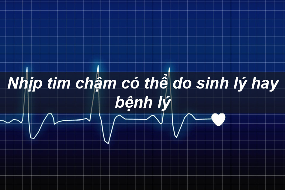 Nhịp tim chậm có thể do sinh lý hay bệnh lý