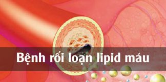 Rối loạn lipid máu