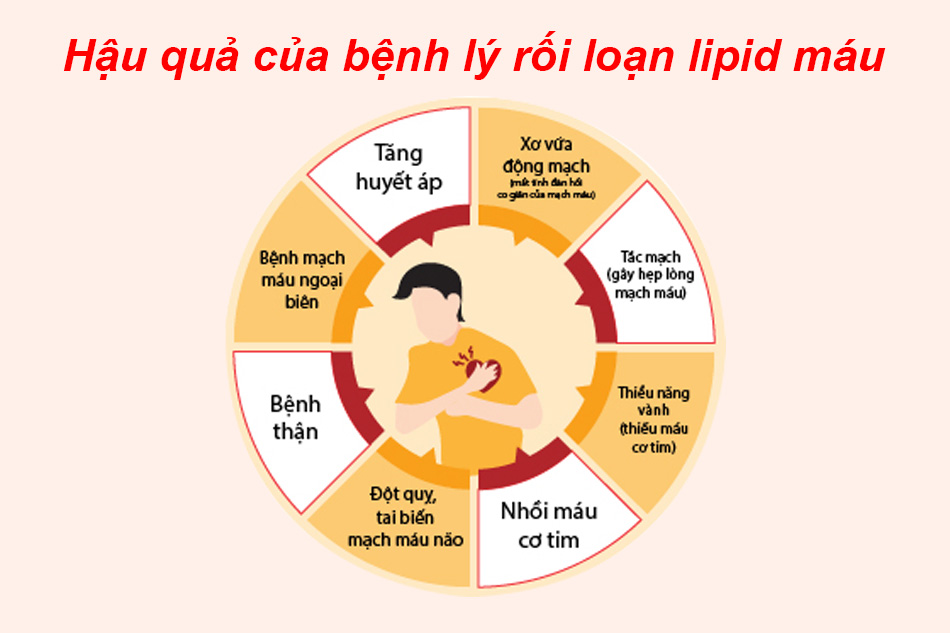 Triệu chứng của bệnh lý rối loạn lipid máu