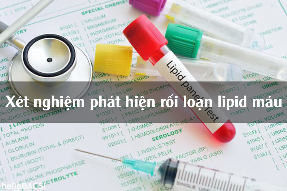 Những xét nghiệm phát hiện rối loạn lipid máu