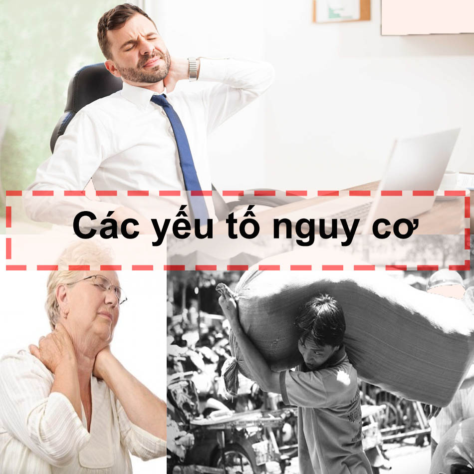 Các yếu tố nguy cơ của thoái hóa đốt sống cổ