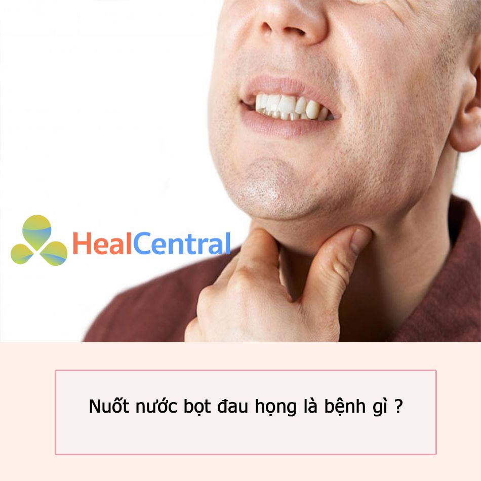 Nuốt nước bọt đau họng là bệnh gì? Nguyên nhân và cách điều trị an toàn