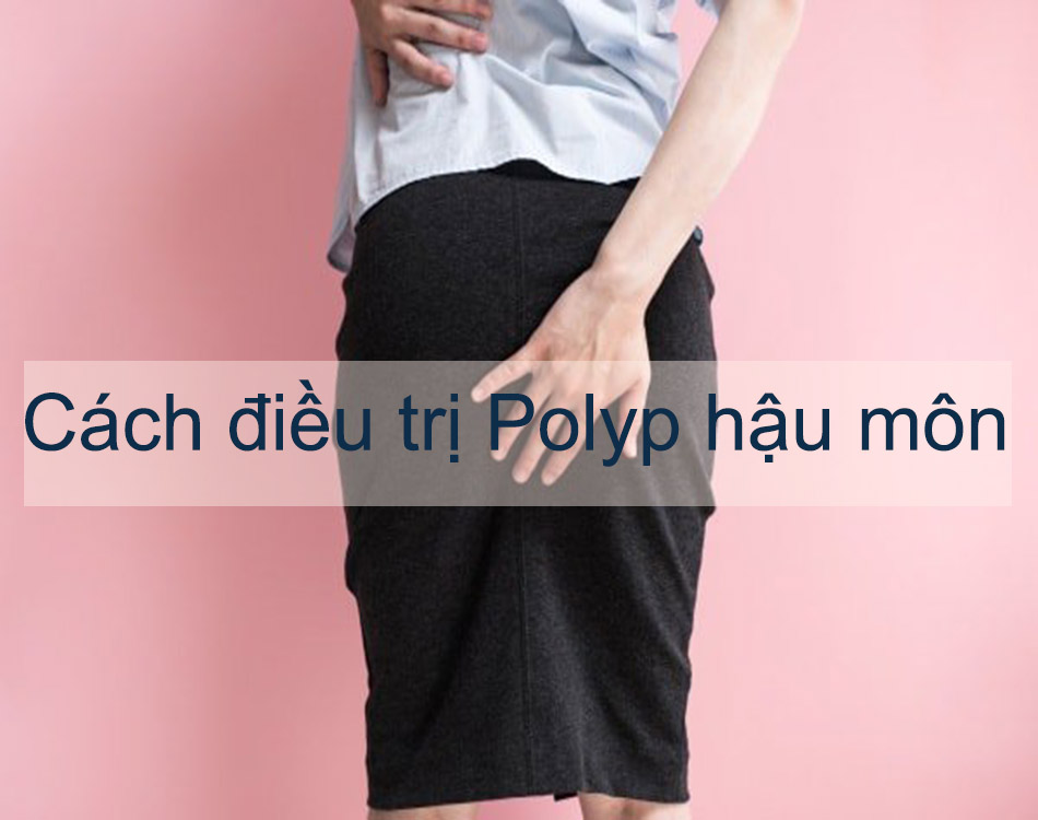 Cách điều trị Polyp hậu môn