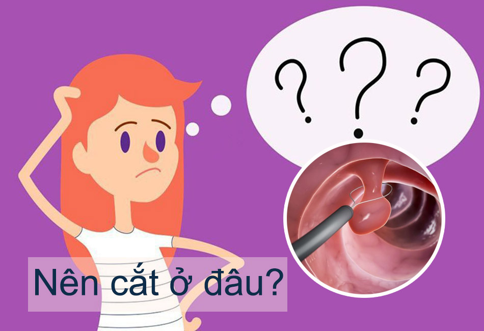 Nên cắt polyp hậu môn ở đâu