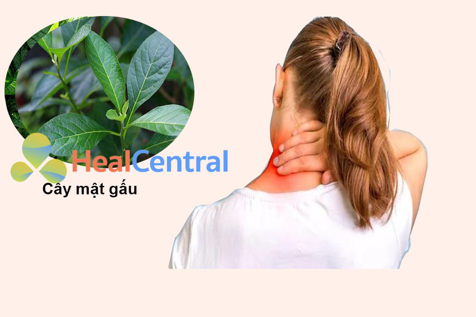 Điều trị thoái hóa đốt sống cổ bằng cây mật gấu