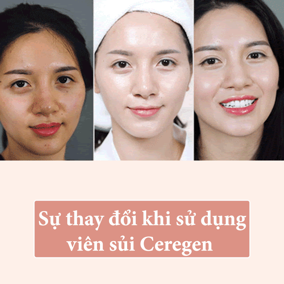 Quy trình làm đẹp da của viên sủi trắng da Ceregen