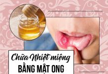 Chữa loét miệng bằng mật ong