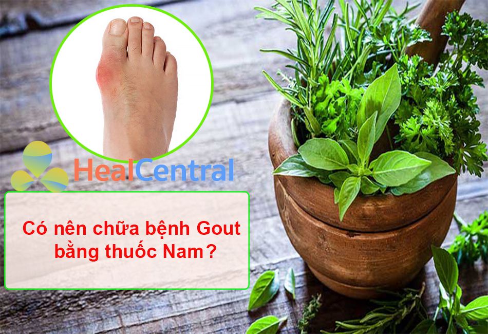 Có nên chữa bệnh Gout bằng thuốc Nam hay không?