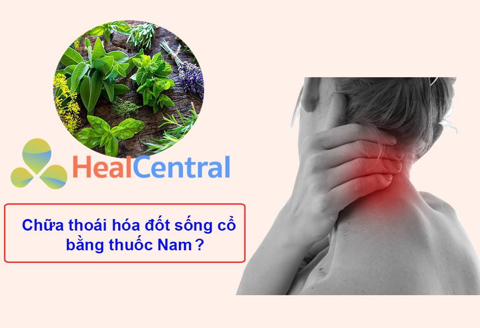 Có nên chữa thoái hóa đốt sống cổ bằng thuốc Nam không?