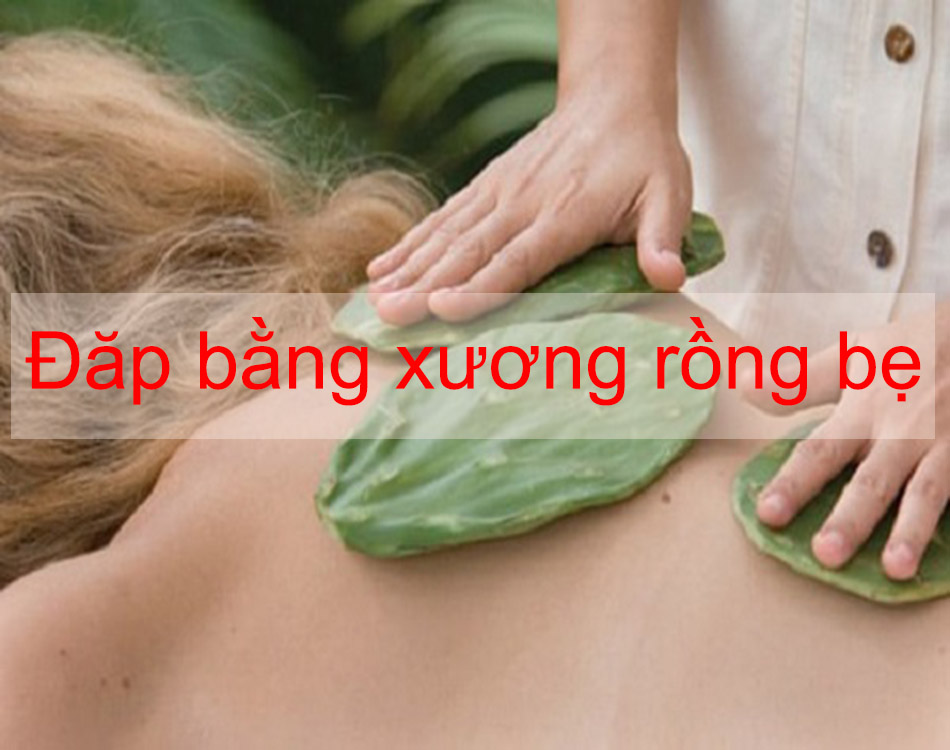 Đắp bằng xương rồng bẹ