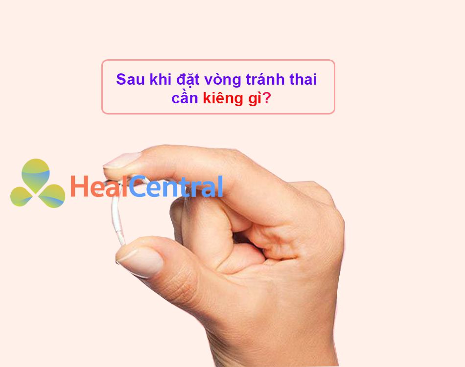 Sau khi đặt vòng tránh thai cần kiêng gì?