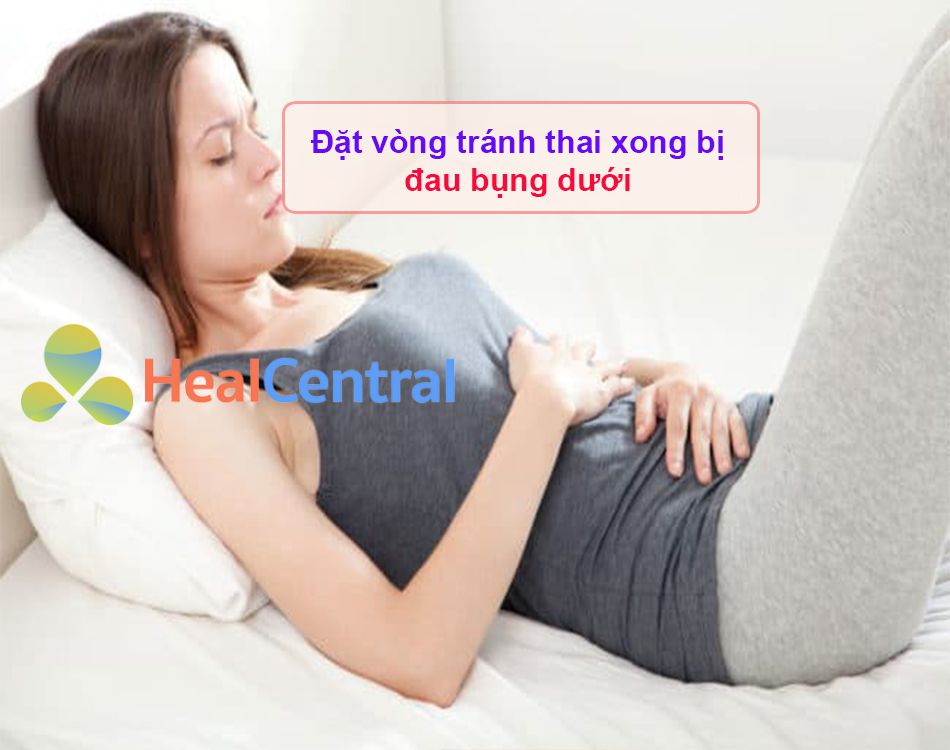 Đặt vòng tránh thai xong bị đau bụng dưới