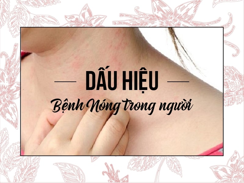 Biểu hiện của bệnh nóng trong người