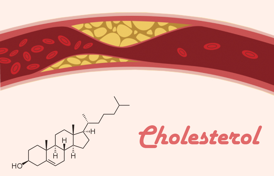 Người bị đau khớp gối nên kiêng các thực phẩm chứa nhiều cholesterol