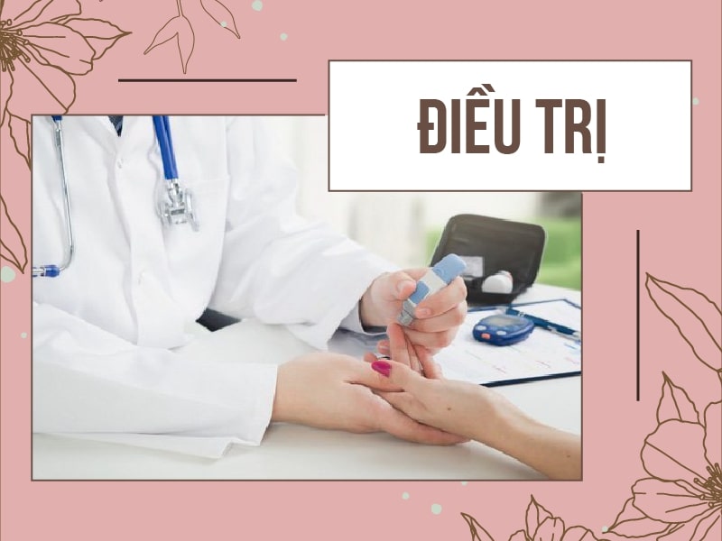 Điều trị bệnh Gout