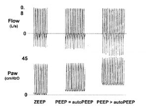 Hình 14. Dạng sóng của lưu lượng và áp lực đường thở (Paw) từ một bệnh nhân bị tắc nghẽn lưu lượng do bệnh phổi tắc nghẽn mạn tính. Áp dụng PEEP bằng với PEEP nội sinh tĩnh (PEEP nội sinh) không làm tăng thể tích phổi (như được đo bằng cách không điều chỉnh áp lực đường thở đỉnh và lưu lượng thở ra). Tăng PEEP áp dụng trên PEEP nội sinh làm tăng áp lực trong lồng ngực (Paw cao), làm tăng thể tích phổi (tăng lưu lượng đỉnh thở ra). ZEEP = áp lực thở ra cuối không.