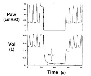 Hình 8. Dạng sóng áp lực đường thở (Paw) và thể tích phổi (Vol) từ một bệnh nhân mắc hội chứng suy hô hấp cấp tính, được thở máy với PEEP 15 cm H2O. Sau khi loại bỏ PEEP và thở ra kéo dài, có thể đo được mức tăng thể tích phổi do PEEP gây ra. Ở dung tích cặn chức năng, việc áp dụng PEEP làm tăng thể tích phổi trong mỗi hơi thở, cho đến khi ổn định đường cơ sở (xem văn bản). ΔV = thay đổi thể tích.