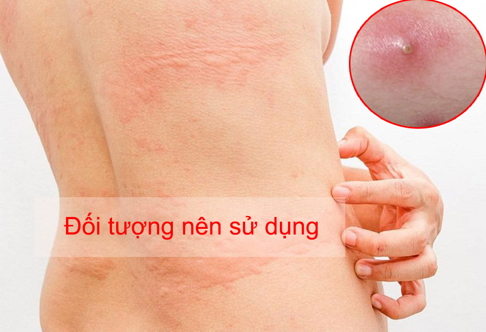 Các đối tượng nên sử dụng Amibebe