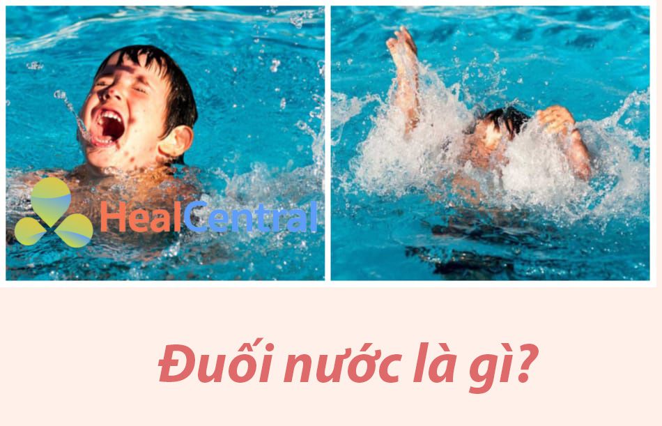 Đuối nước (chết đuối) là gì?