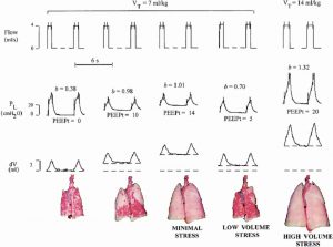 Hình 2. Bản ghi dữ liệu đại diện cho thấy các biến số sinh lý (lưu lượng, áp lực xuyên phổi [PL] và thay đổi thể tích phổi [ΔV]) và sự xuất hiện khi cuối thì thở ra của phổi bị cắt trong các điều kiện thí nghiệm khác nhau.