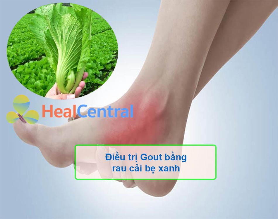 Chữa bệnh gout bằng rau cải bẹ xanh