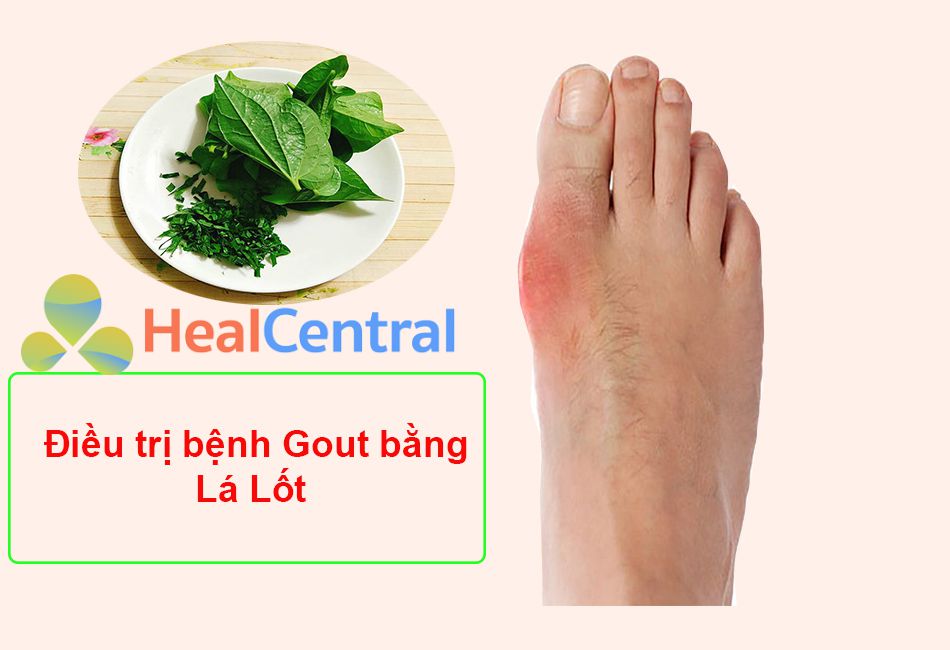 Điều trị Gout bằng lá lốt