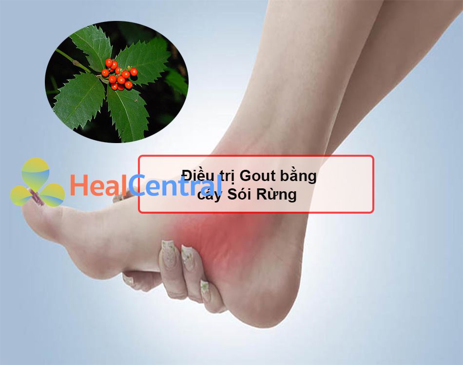 Điều trị Gout bằng cây Sói Rừng