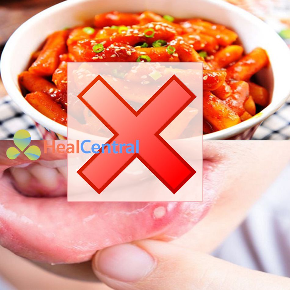 Không nên ăn thực phẩm cay nóng