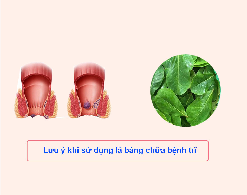 Lưu ý khi sử dụng lá bàng chữa bệnh trĩ