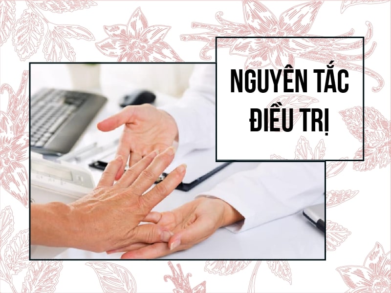 Nguyên tắc điều trị viêm khớp dạng thấp