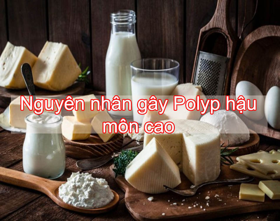 Nguyên nhân gây polyp hậu môn cao