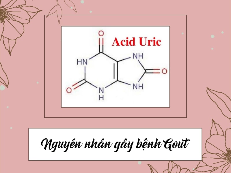 Acid Uric là nguyên nhân gây ra bệnh Gout