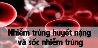 Nhiễm trùng huyết nặng và sốc nhiễm trùng