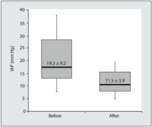 Hình 8. Boxplot cho thấy hiệu quả của việc loại bỏ dịch truyền (sau) đối với áp lực trong ổ bụng (IAP, mm Hg). Đường liền nét biểu thị IAP trung vị với phạm vi liên dải