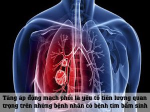 Tăng áp động mạch phổi là yếu tố tiên lượng quan trọng trên những bệnh nhân có bệnh tim bẩm sinh