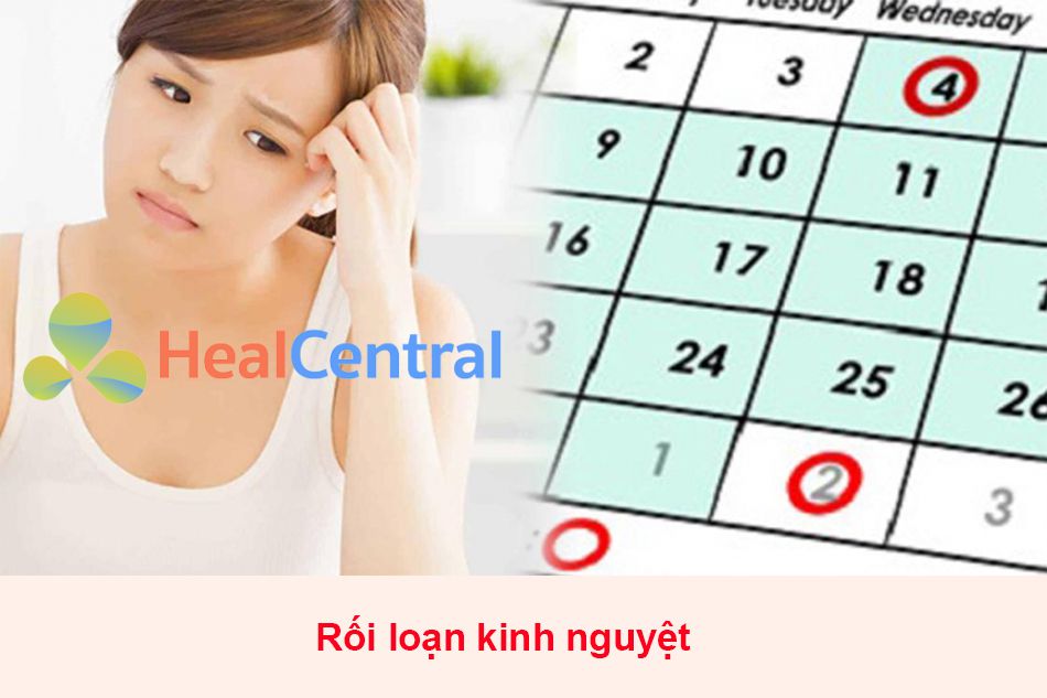 Rối loạn kinh nguyệt là gì?