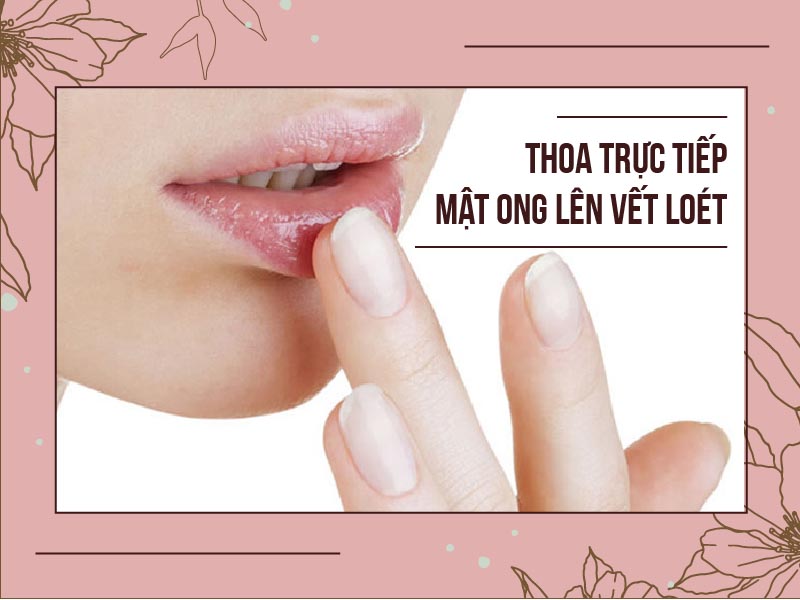 Thoa mật ong lên vết loát giúp dưỡng ẩm hiệu quả